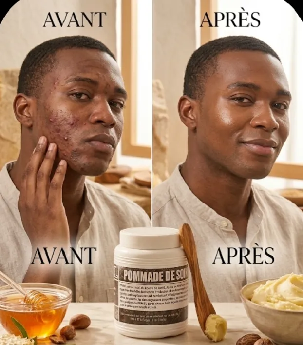 POMMADE DE SOINS POMIEL - Vue 3